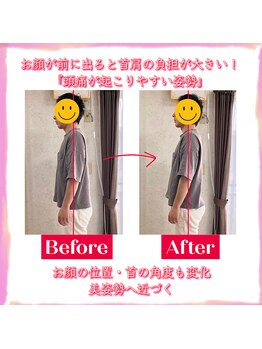 カルラ(KARURA)/頭痛/肩こり/腰痛は姿勢から改善