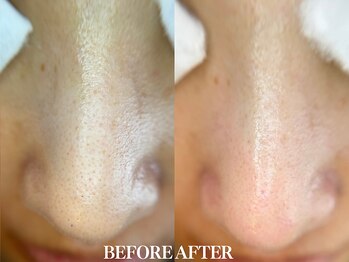 サロン ムスブ(salon MUSUBU)/山梨エステ/甲府エステ