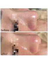 リンデザ(LINDEZA)/触って見て感じれる