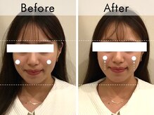 ハリラウンジ 梅田店(Hari Lounge)/美容鍼専門サロン Hari Lounge