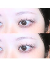 アイリス(AIRIS)/目力UP&中顔面短縮