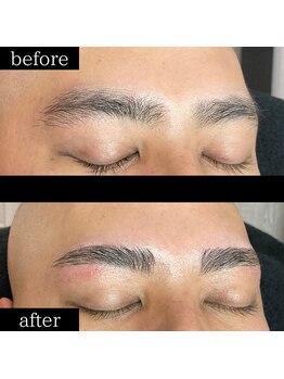 ユー 千葉駅前店(you)/症例写真