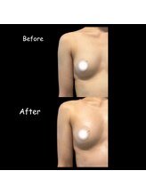 ザ レディービー(The Lady B)/バストアップ