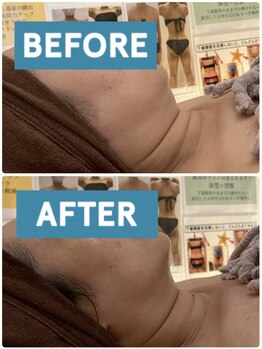 ヴォアール 東静岡店(VOIR)/韓国製脂肪分解!レモンボトル