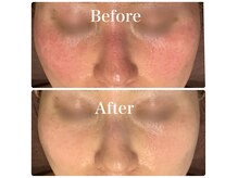 ラグーナ(Laguna)の雰囲気（急な肌トラブル鎮静・長年の肌悩みにじっくり根本からの肌育美容）