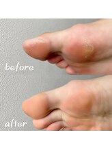 アオドットネイル(Ao. Nail)/角質ケア