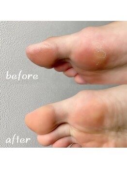 アオドットネイル(Ao. Nail)/角質ケア