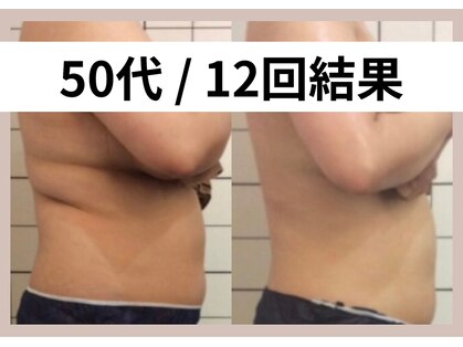 リストアミー(Restore me)の写真