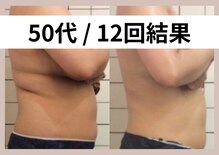 リストアミー(Restore me)