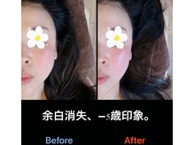 美容矯正サロン レレポノ(LELEPONO)/