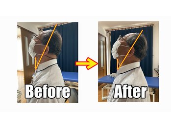 治療院 春の風/10分の施術で頚椎可動域拡大!