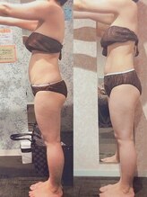 パーフェクトボディプレミアム 大阪難波店(PERFECT BODY PREMIUM)/お客様　ビフォーアフター（33）