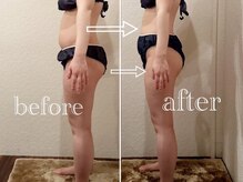 チェルシーロイヤルエステティックサロン(CHELSEA)/パーソナルダイエットエステ