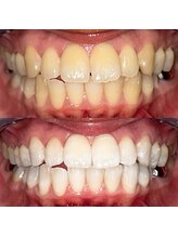 ライトビューティー 池袋店(LightBeauty)/症例写真