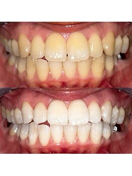 ライトビューティー 池袋店(LightBeauty)/症例写真