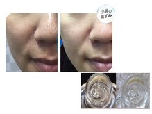 プライムデュオ(Prime Duo)/毛穴の奥までうるおい洗浄