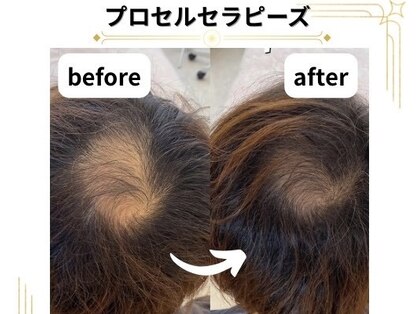 ウィズサロン(withサロン)の写真