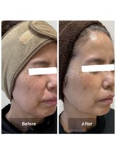 グレイス(Grace)/