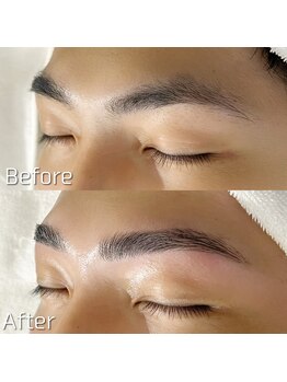 エースリー(A+3)/メンズアイブロウリフト