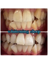 ホワイトニングショップ 越谷店/