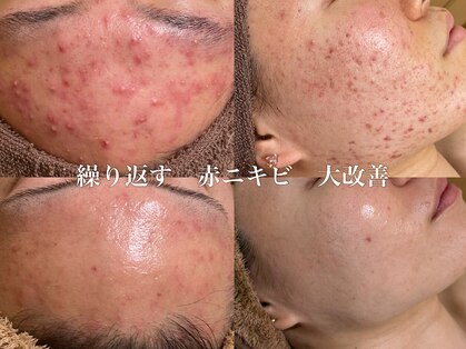 ラクシュミー ナチュラル(Laksmy NATURAL)の写真