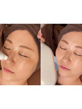 お肌をきれいにしたい