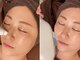 アリュール(ALLURE)の写真/【黒ずみ開き毛穴/皮脂/テカリ肌徹底改善◎】即効果実感★繰り返すニキビや長年のニキビでお悩みの方に◎