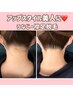 ヘアアップして後ろ姿美人【うなじ，襟足脱毛】¥4840→¥4400