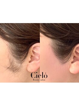 1回ごとにお支払い可能なサロン