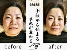 クレスト(CREST)