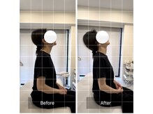 エモアメディカル整体院 麻布十番(Emoaメディカル整体院)/【30代女性】頸部・肩周囲の症状