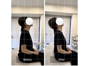 エモアメディカル整体院 麻布十番(Emoaメディカル整体院)/【30代女性】頸部・肩周囲の症状