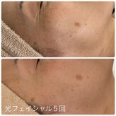 プルメリスタ 八千代緑が丘店