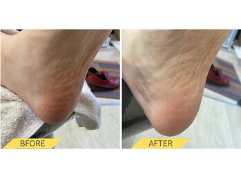 ふっとけ庵/足裏角質ケア(かかと)