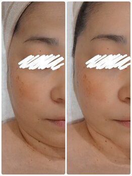 ネシア(nesia)/クイック美肌フォト