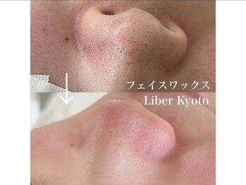 エステティック リベル キョウト 京都駅前店(Esthetic Liber Kyoto)/フェイスワックス脱毛
