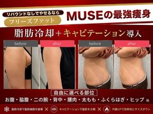 ミューズ よもぎ蒸し(MUSE)の雰囲気（【脂肪冷却】1度で約20％の脂肪を撃退でリバウンド無　都度払い）