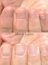 マリーロール 梅田店(Marie Laure)/自爪育成/深爪矯正/ネイルケア