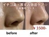 イチゴ鼻・黒ずみ徹底ケア☆お鼻集中コース