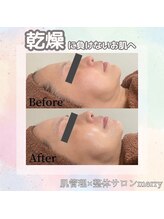 メリー 大和八木店(merry)/乾燥知らずのちゅるん肌へ♪