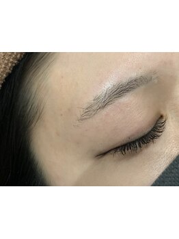 顔脱毛がしたい