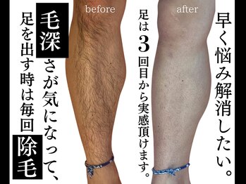 ジェントルメンズグロー(Gentlemen’s Glow)/【足・腕・脇脱毛】