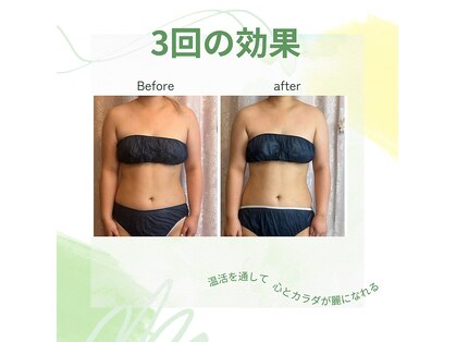 ヨサ パーク コアハート(YOSA PARK CORE HEART)の写真