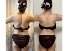 ヨサパーク レイ 等々力(YOSA PARK Ray)/お客様の変化　全身水素コース