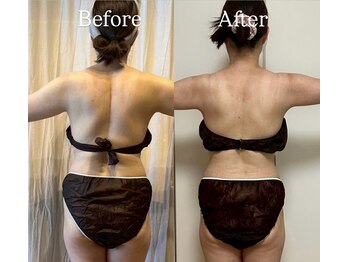 ヨサパーク レイ 等々力(YOSA PARK Ray)/お客様の変化　全身水素コース