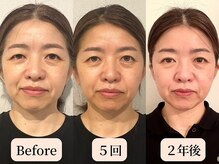 ロシュニ/40代 お悩み:歪み/慢性腰痛