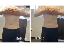 北上美腸サロン/下がり腸・たまり腸