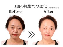 ケー(K)/ビフォーアフター