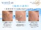 《韓国美容専門店》BELL BEAUTY SALON &nbsp;&nbsp;小顔/毛穴洗浄/シミ/痩身の写真/【7日後に剥がれる!?】超最新ホワイトラボの"剥がすシミケア"に予約殺到★最短×効果でシミ改善したい方に!