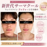 エクラヴィ(Eclatvie)